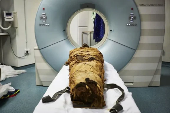 An ancient Egyptian mummy, Nesyamun, laid on the couch to be CT scanned at Leeds General Infirmary